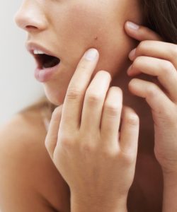psorasis