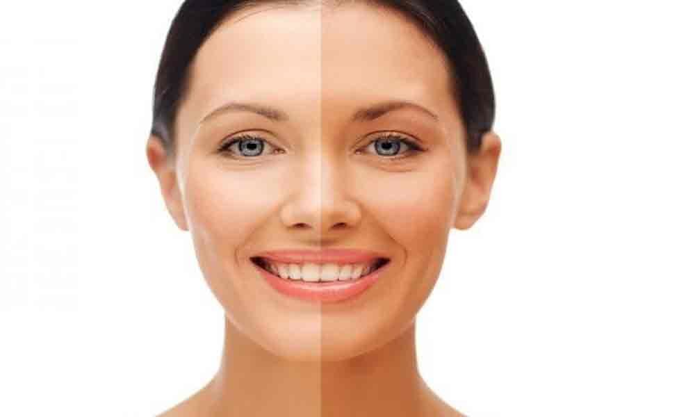 melanotan ii injections