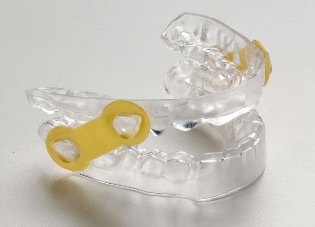 Anti-Snoring Device